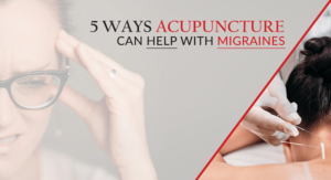 5 WAYS ACUPUNCTURE CAN HELP WITH MIGRAINES min