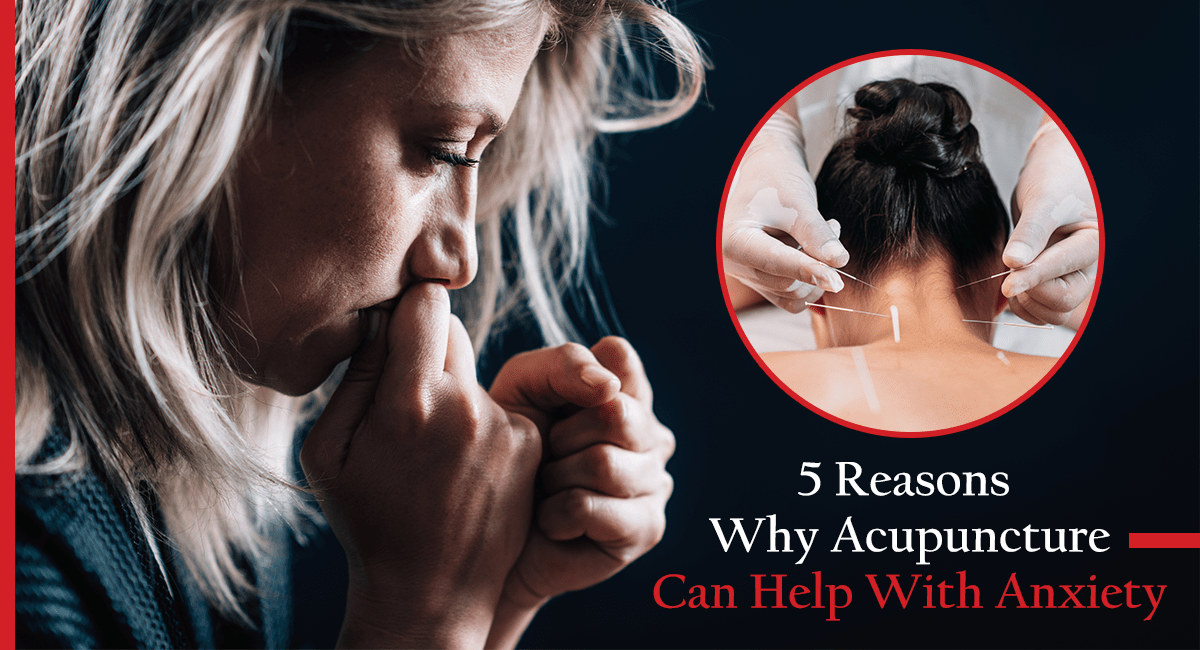 5 Reasons Why Acupuncture Can Help With Anxiety min 1