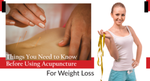 Things You Need to Know Before Using Acupuncture for Weight Loss min